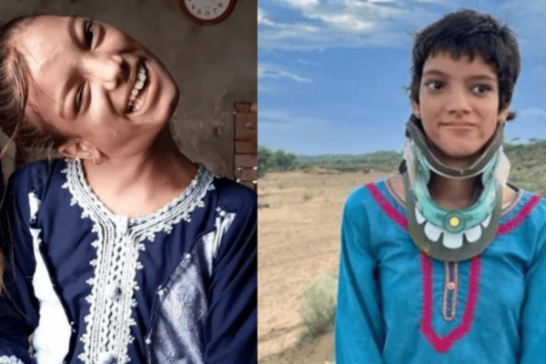 Milagre! Menina que viveu 13 anos com o pescoço a 90º e rejeitada por todos os médicos, consegue ser operada e resultado surpreende