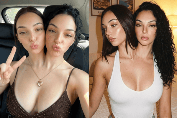 “Gêmeas siamesas” conquistam 400 mil seguidores, mas verdade é revelada