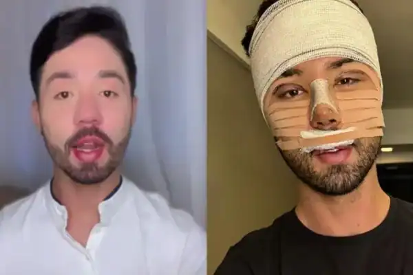 Rico Melquiades desaparece das redes e realiza nova cirurgia estética; veja detalhes