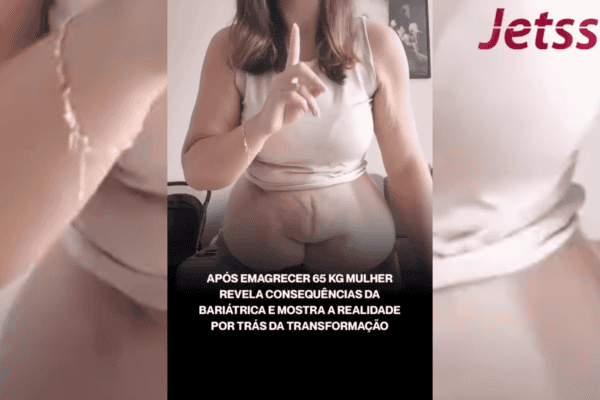 Após emagrecer 65 kg, mulher revela consequências da bariátrica e mostra a realidade por trás da transformação