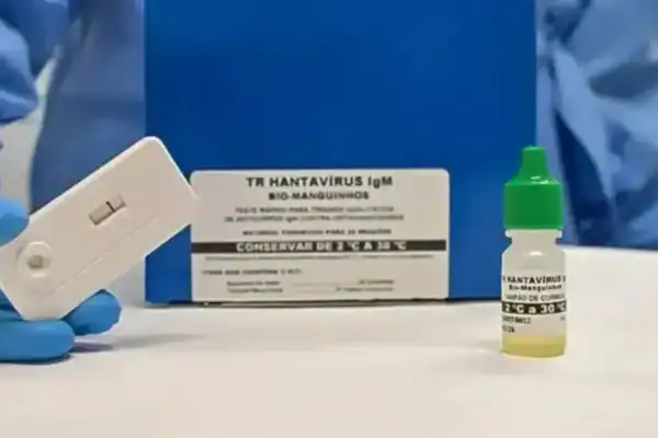Paraná confirma dois casos de hantavírus e investiga outros onze