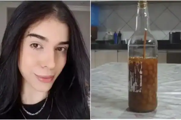Jovem que teve grave reação ao cheiro de pimenta é internada novamente