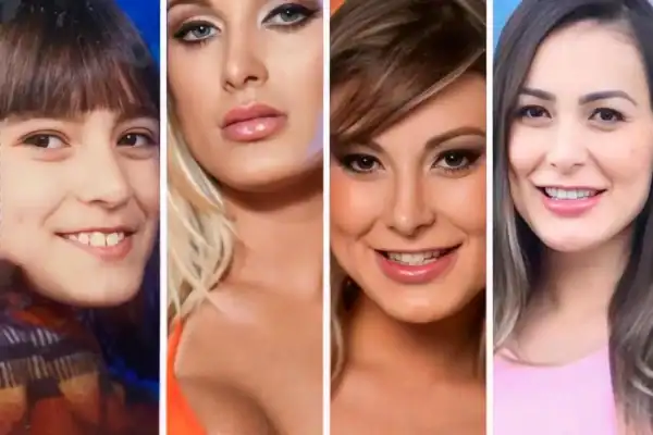 Andressa Urach impressiona a web ao exibir rosto após nova cirurgia; confira vídeo