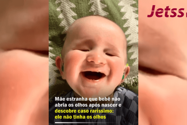 Mãe estranha que bebê não abria os olhos após nascer e descobre caso raríssimo: ele não tinha os olhos