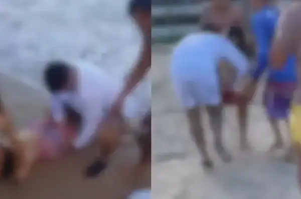 Jovem perde a perna em novo ataque de tubarão em apenas dois dias no litoral brasileiro