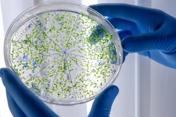 Bactéria encontrada em produtos Ypê e Crystal adota mecanismo eficiente de sobrevivência