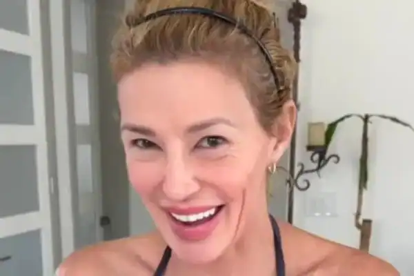 Ex-estrela de reality diz que parasita que ‘derreteu’ seu rosto retornou