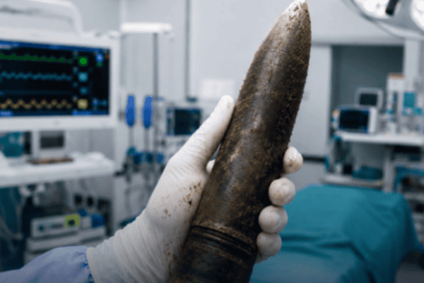 Homem vai ao hospital com projétil de 20 cm no reto e médicos acionam equipe antibombas