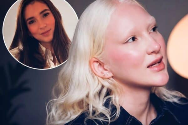 Michael Jackson? A história da mulher que mudou completamente de cor de forma definitiva