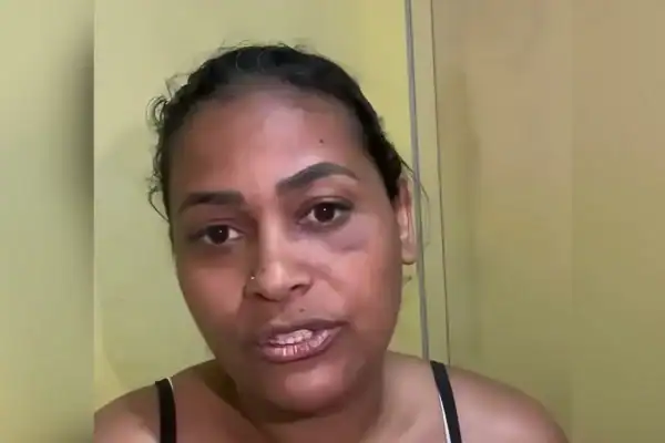 Influenciadora arranca dedo de mulher após mordida em festa de São João