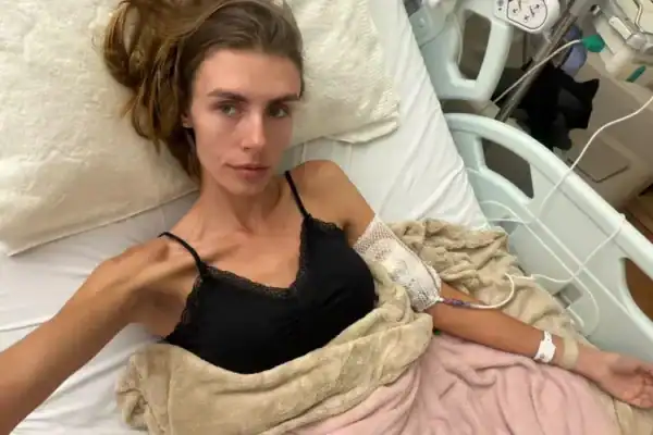 Joana Purin, modelo paulista, é internada em estado grave após usar retatrutida ilegal