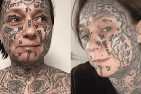 Após relacionamento abusivo, mulher remove tatuagens feitas à força